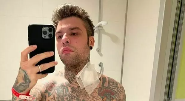 Fedez nuovo 